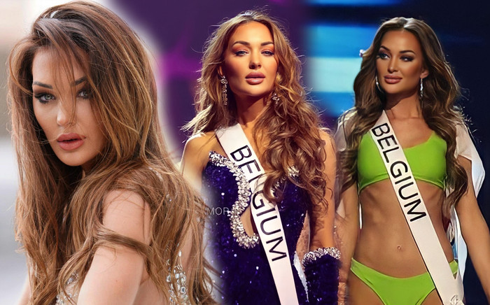 Fan 'đau lòng' trước nhan sắc của hoa hậu gặp tai nạn xe: Gương mặt bị ảnh hưởng nhiều do va chạm Ảnh 2