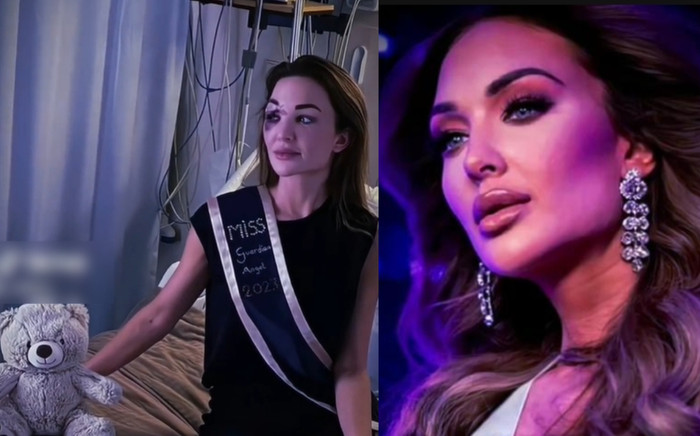 Xót xa ảnh Hoa hậu Hoàn vũ Bỉ bị tàn phá nhan sắc do tai nạn, final walk không thể thực hiện Ảnh 2