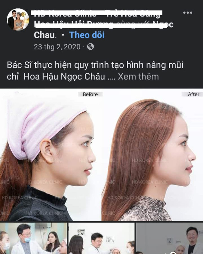 Hình ảnh thể hiện sự thay đổi trước và sau của hoa hậu Ngọc Châu. 