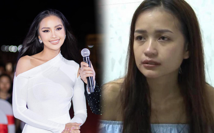 Ngọc Châu lộ ảnh 'đập đi xây lại' toàn bộ gương mặt dù đã từng phủ nhận chuyện dao kéo Ảnh 2