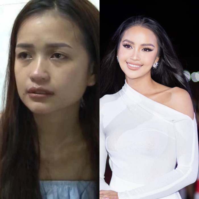 Có thể thấy, ở thời điểm hiện tại diện mạo của Ngọc Châu rất khác. Ở một số khoảnh khắc, gương mặt của người đẹp được đánh giá là bị cứng, có biểu cảm khá đơ.