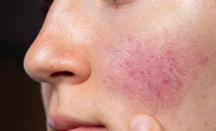 Ảnh minh họa: Shutterstock