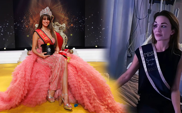 Hoa hậu Bỉ gặp biến nặng: Người tiền nhiệm bị tai nạn, người kế nhiệm vướng sự cố khi đăng quang Ảnh 2