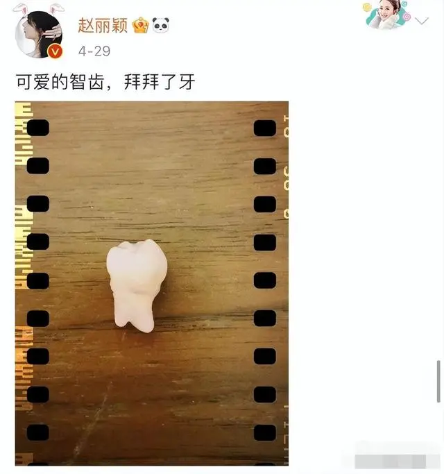 Trước đây nàng tiểu hoa cũng từng đăng hình mình đi nhổ răng để dập tắt tin đồn phẫu thuật thẩm mĩ.
