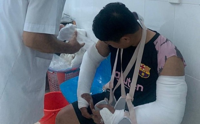 Đặt hàng nhưng không muốn nhận, hai vợ chồng dùng tuýp sắt và ghế inox đánh gãy 2 tay người giao hàng Ảnh 2