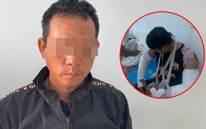 Vụ nam shipper bị đánh gãy 2 tay ở Quảng Ngãi: Bắt khẩn cấp đối tượng ra tay Ảnh 2