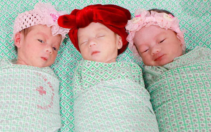 Hiếm gặp: Mổ đẻ thành công cho sản phụ mang tam thai cùng trứng Ảnh 2