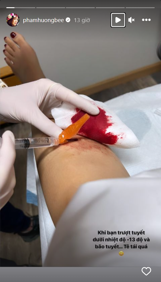 Phạm Hương chia sẻ hình ảnh cô phải nhập viện khi xảy ra sự cố trong lúc trượt tuyết.