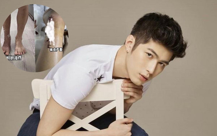 Một nam diễn viên bị tai nạn bị thương nặng, phải ngồi xe lăn Ảnh 2