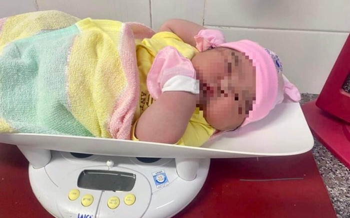 Bé gái sơ sinh chào đời với cân nặng 'khủng' 6kg Ảnh 2