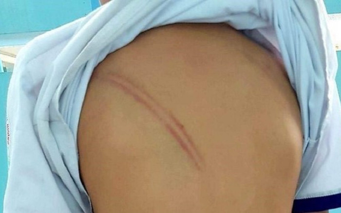 'Điên tiết' đánh con chồng vì 20.000 đồng, mẹ kế không ngờ đến hậu quả Ảnh 2