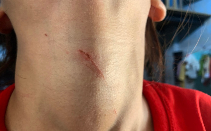 Cô gái 17 tuổi phải đối diện với cảnh kinh hoàng sau câu nói 'tao vã lắm rồi' của gã thanh niên Ảnh 2