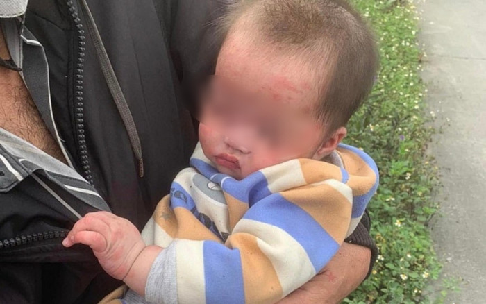 Phát hiện bé gái 7 tháng tuổi bị bỏ rơi bên vệ đường, thấy điều này trên mặt bé khiến ai cũng xót xa Ảnh 2