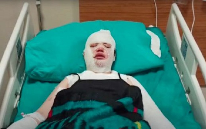 Người phụ nữ đang ngủ bị dội nước sôi vào người, không ngờ danh tính hung thủ Ảnh 2