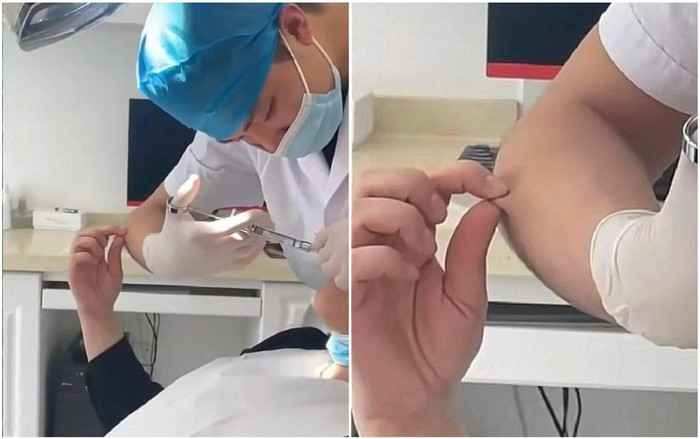 Sợ đau lúc đi tiêm, thanh niên hành động bất ngờ với bác sĩ: Kẻ tổn thương lại muốn tổn thương người khác Ảnh 2
