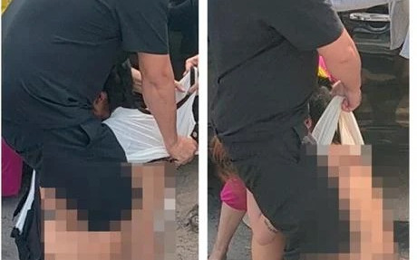 Sức khỏe của cô gái 18 tuổi bị đánh ghen, lột quần áo giữa phố Bình Dương hiện ra sao? Ảnh 2