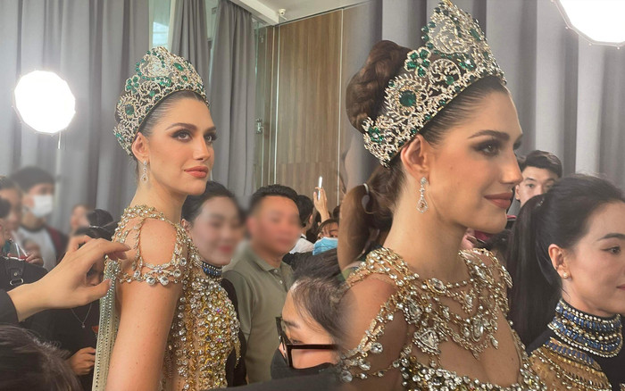 Cận cảnh nhan sắc Hoa hậu đẹp nhất thế giới qua cam thường: Cũng lấm tấm mụn như ai! Ảnh 2