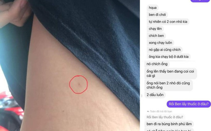 Xôn xao thông tin thiếu niên 16 tuổi bị 2 phụ nữ lạ mặt chích kim tiêm khi đang đi tập thể dục Ảnh 2