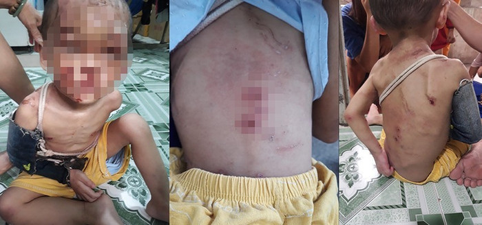  Vụ bé trai nghi bị cha mẹ đánh đập dã man: Tiết lộ bất ngờ từ người thân Ảnh 2