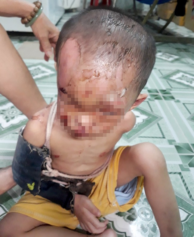  Vụ bé trai nghi bị cha mẹ đánh đập dã man: Tiết lộ bất ngờ từ người thân Ảnh 1