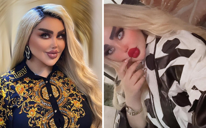 Phẫu thuật 43 lần vì muốn giống búp bê Barbie, cô gái nhận về cái kết đắng Ảnh 2