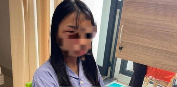 Nữ sinh bị đánh hội đồng đã được đưa đến bệnh viện để giám định thương tích