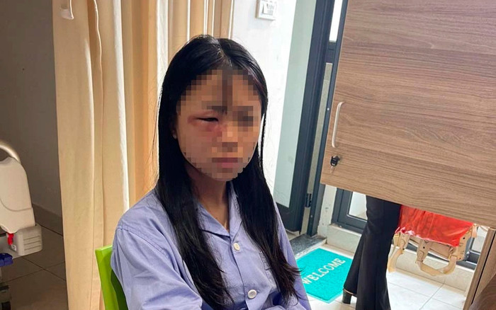 Xót xa bức thư nữ sinh bị đánh hội đồng: Con không nói với ba mẹ vì con nghĩ con chịu đựng được Ảnh 2