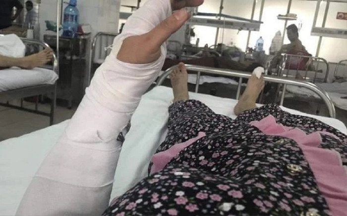 Tình trạng người phụ nữ bị chồng đánh đập dã man đến bất tỉnh hiện giờ ra sao? Ảnh 2