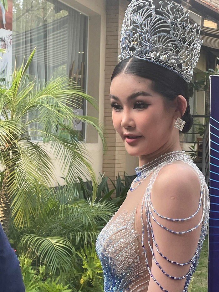  Nhan sắc 'bất ổn' của Hoa hậu Lê Âu Ngân Anh qua cam thường, khác xa so với mạng xã hội? Ảnh 2