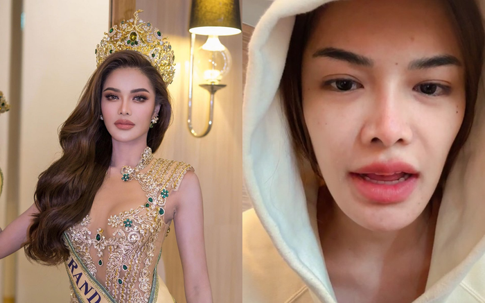 'Vỡ mộng' với mặt mộc Miss Grand Thailand 2023, gây tranh cãi vì khác xa khi trang điểm Ảnh 1