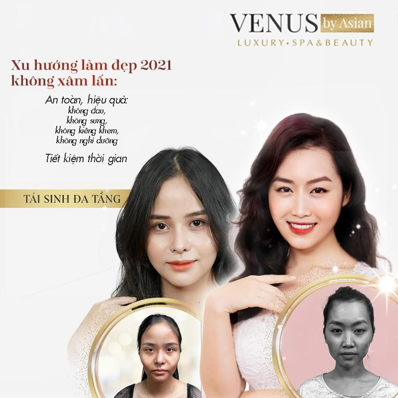 Tái sinh đa tầng công nghệ làm đẹp không xâm lấn đi đầu 2021 Ảnh 1