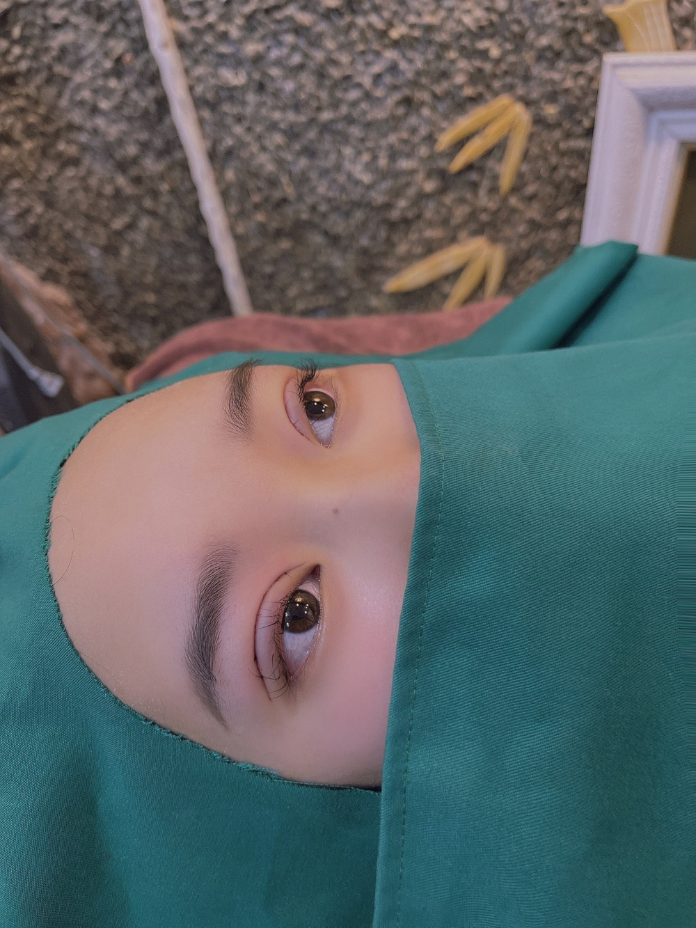 Cắt mí nâng cơ Plasma tại Nataly The Beauty & Spa của Ceo Nguyễn Kiều Anh Ảnh 2