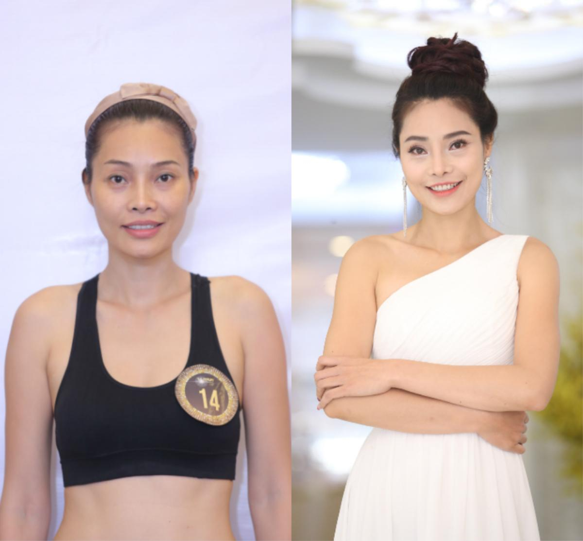 Bất ngờ trước loạt ảnh trước và sau 'dao kéo' của thí sinh The Beauty 2017 Ảnh 13