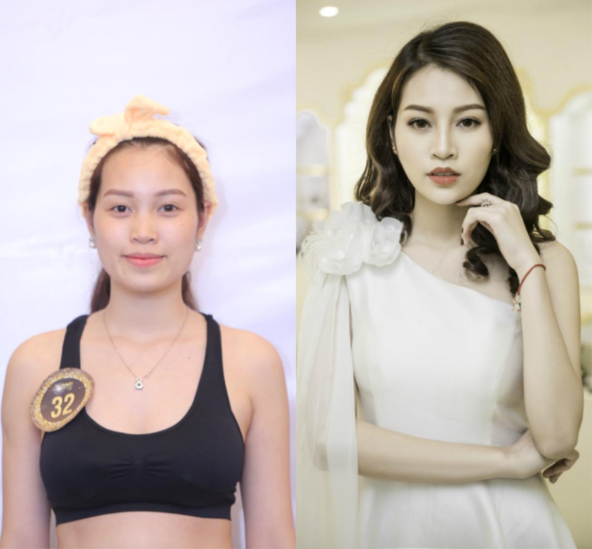 Bất ngờ trước loạt ảnh trước và sau 'dao kéo' của thí sinh The Beauty 2017 Ảnh 15