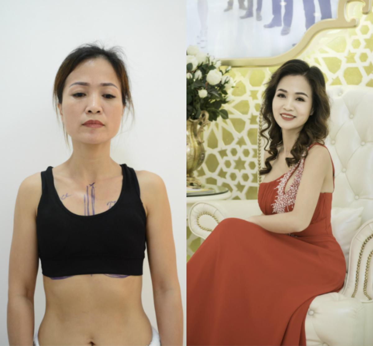 Bất ngờ trước loạt ảnh trước và sau 'dao kéo' của thí sinh The Beauty 2017 Ảnh 16