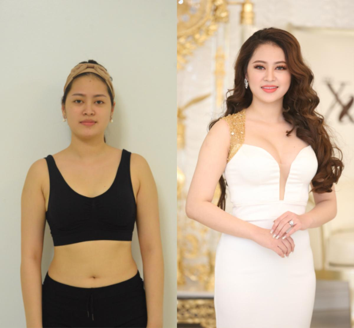 Bất ngờ trước loạt ảnh trước và sau 'dao kéo' của thí sinh The Beauty 2017 Ảnh 2