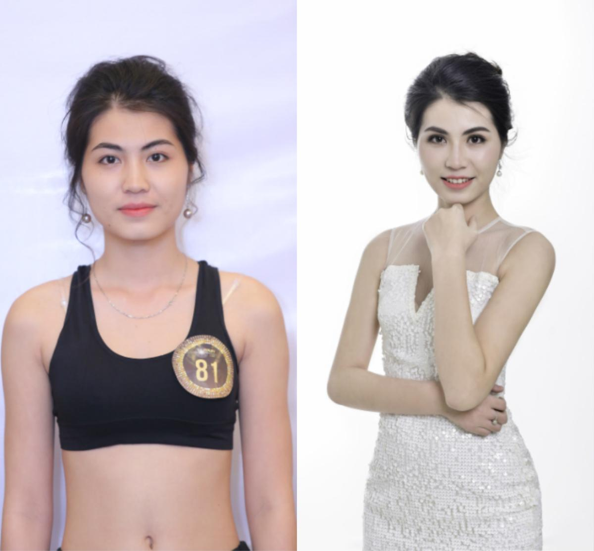 Bất ngờ trước loạt ảnh trước và sau 'dao kéo' của thí sinh The Beauty 2017 Ảnh 4