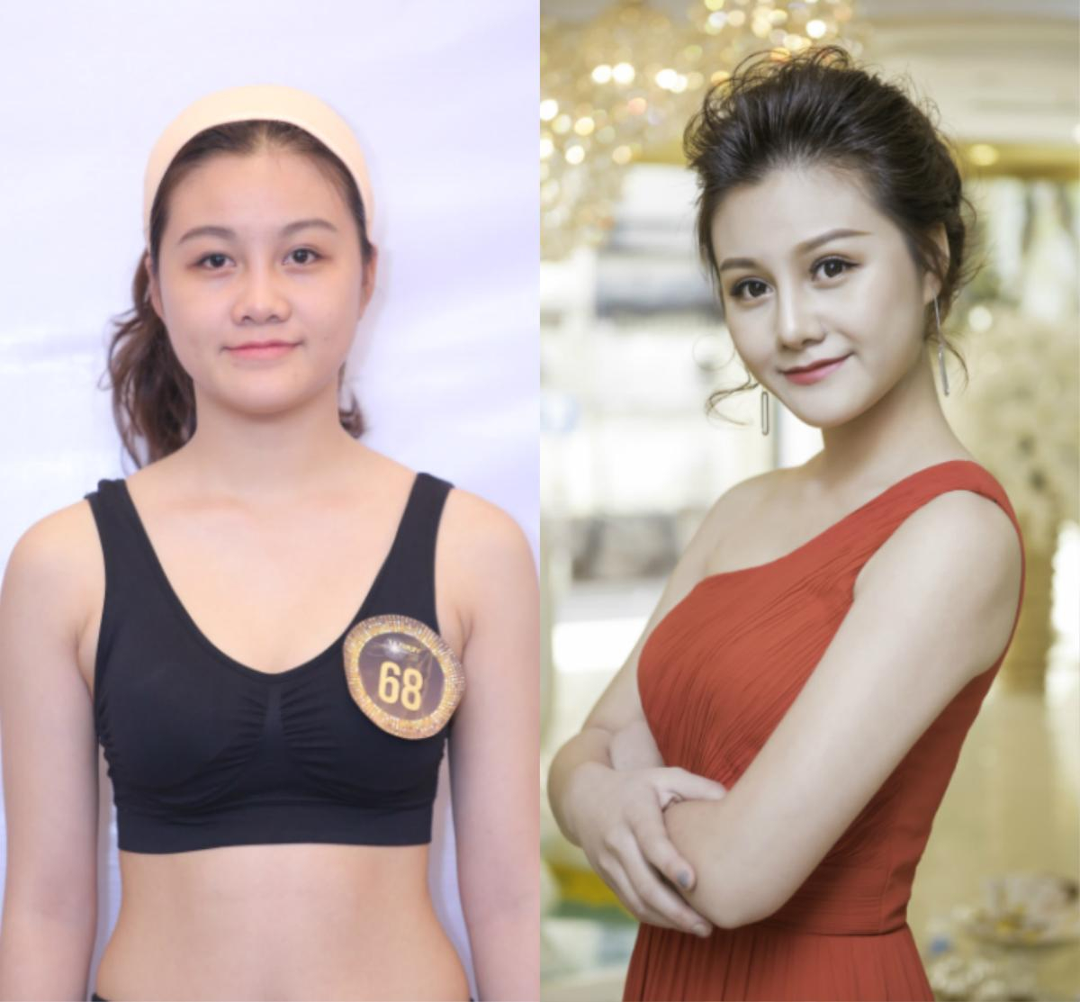 Bất ngờ trước loạt ảnh trước và sau 'dao kéo' của thí sinh The Beauty 2017 Ảnh 5