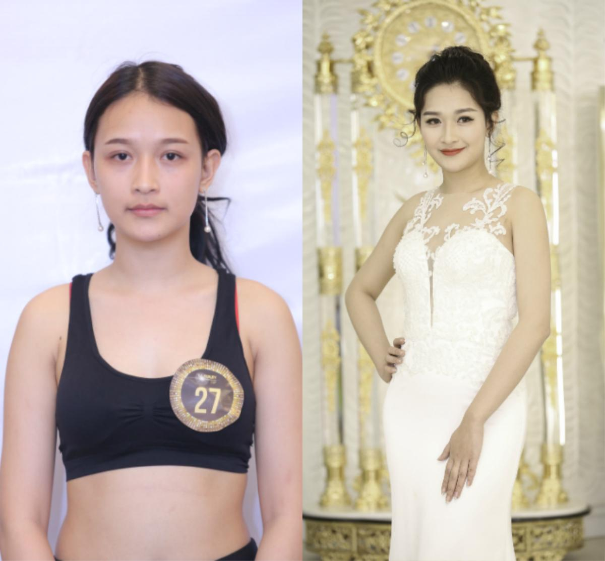 Bất ngờ trước loạt ảnh trước và sau 'dao kéo' của thí sinh The Beauty 2017 Ảnh 8