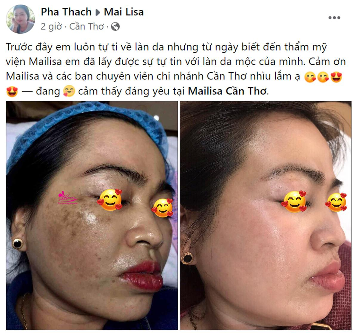 Thực hư Mailisa Cần Thơ có thật sự tốt không? Ảnh 3