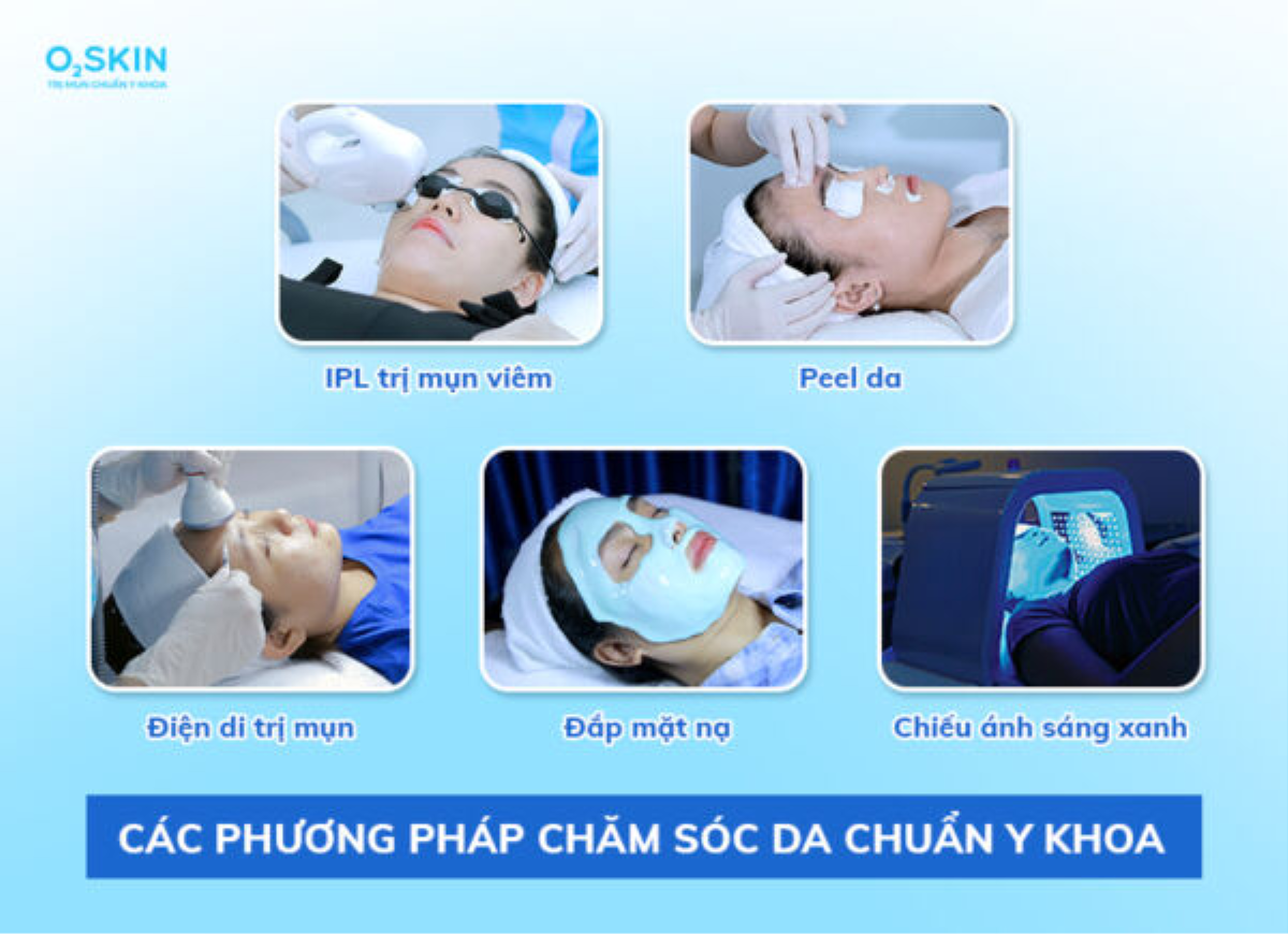 Bác sĩ da liễu chia sẻ: Cách trị mụn viêm hiệu quả, tiết kiệm, phù hợp cho từng người Ảnh 1