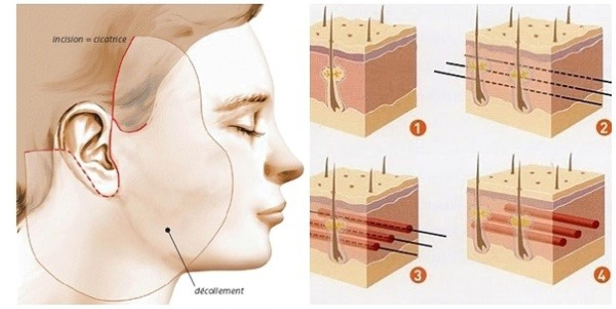 Bỏ túi ngay 5 công nghệ chống lão hóa “được lòng” giới doanh nhân Ảnh 5