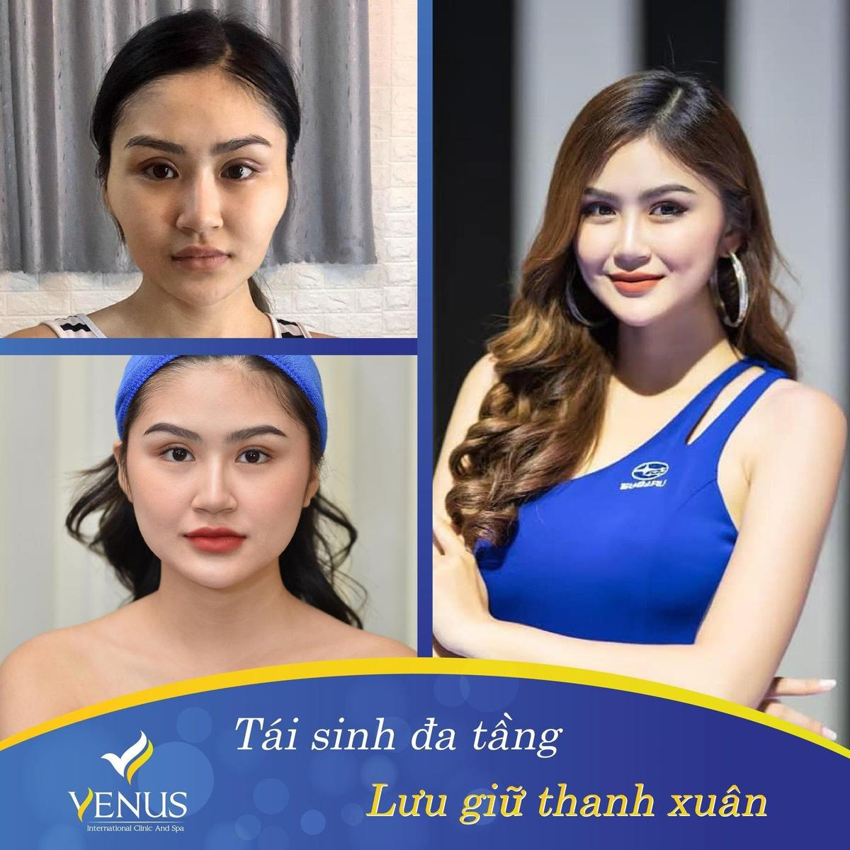 Thực hư sau những thông tin tiêu cực tại Thẩm mỹ viện Quốc tế Venus Ảnh 4