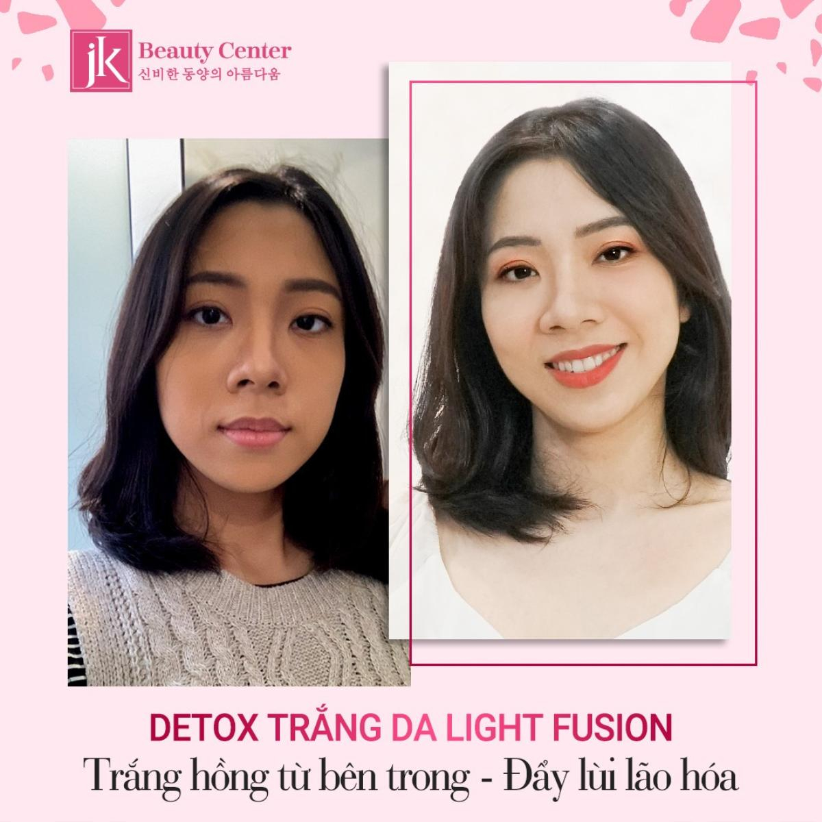 Detox trắng da - Light Fusion khắc tinh của làn da đen sạm, lão hóa chinh phục hàng ngàn phụ nữ Việt Ảnh 3