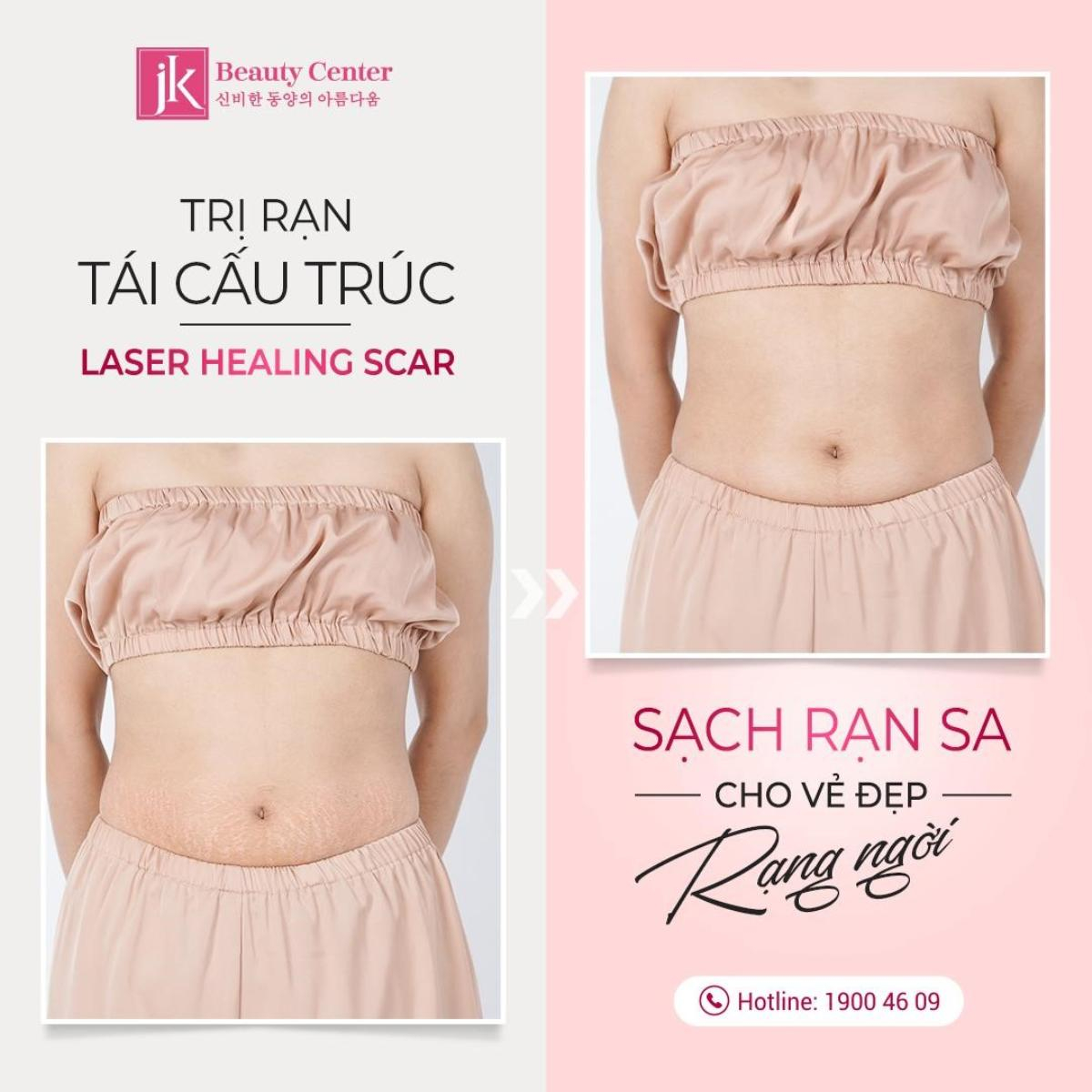 Công nghệ Tái cấu trúc Healing Scar dẫn đầu xu hướng trị rạn Ảnh 4