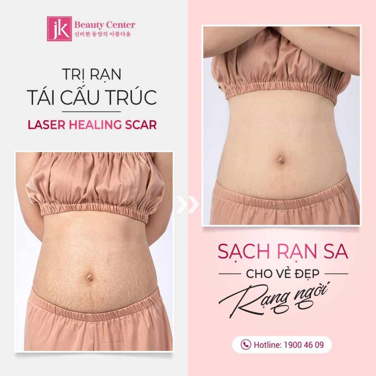 Công nghệ Tái cấu trúc Healing Scar dẫn đầu xu hướng trị rạn Ảnh 5