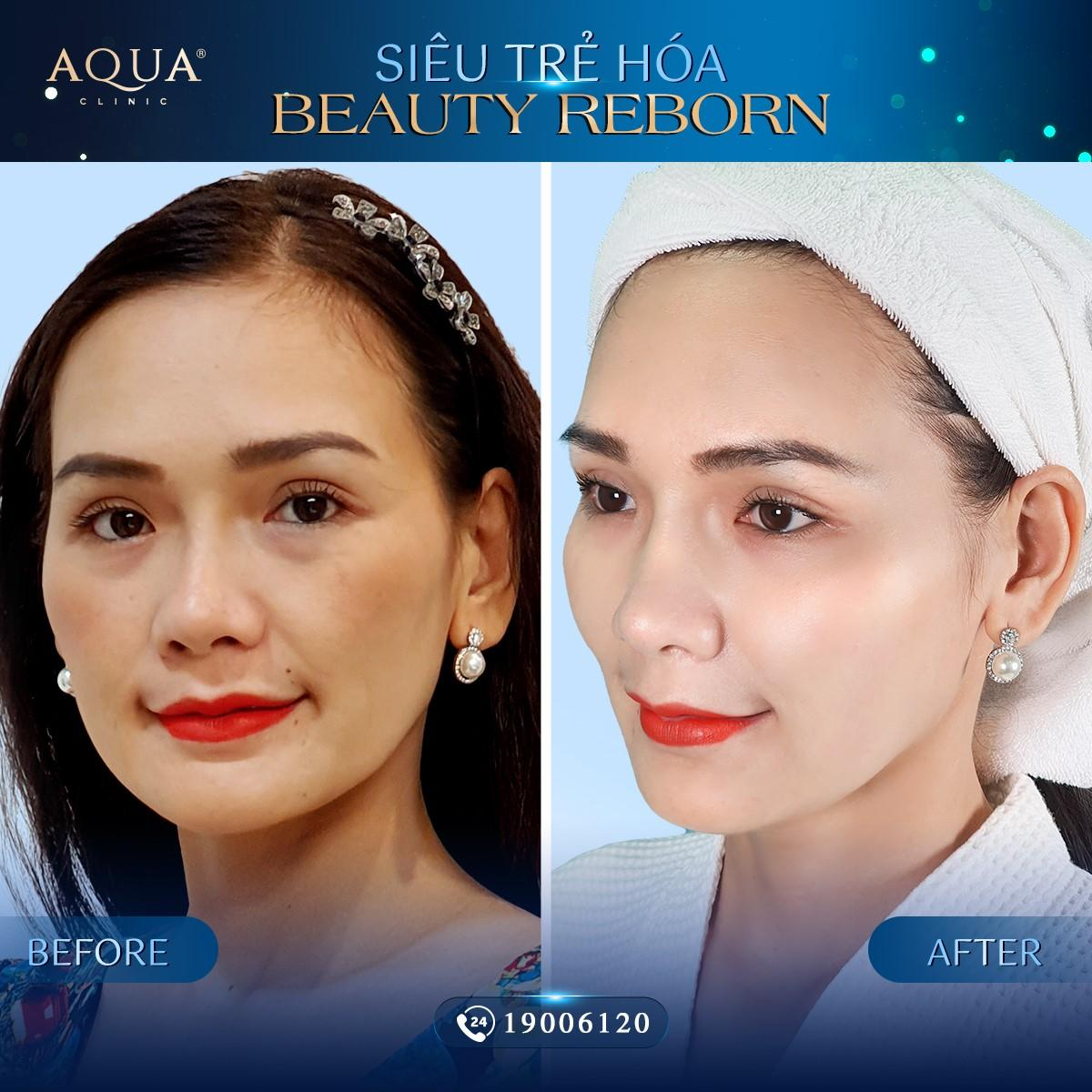 Beauty Reborn - Phương pháp trẻ hoá mới được nghệ sĩ ưa chuộng Ảnh 4