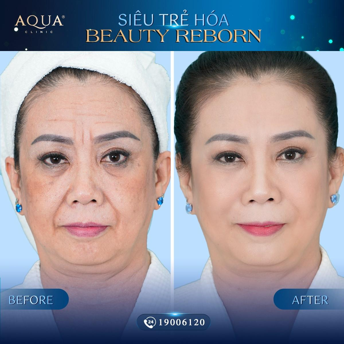 Beauty Reborn - Phương pháp trẻ hoá mới được nghệ sĩ ưa chuộng Ảnh 3