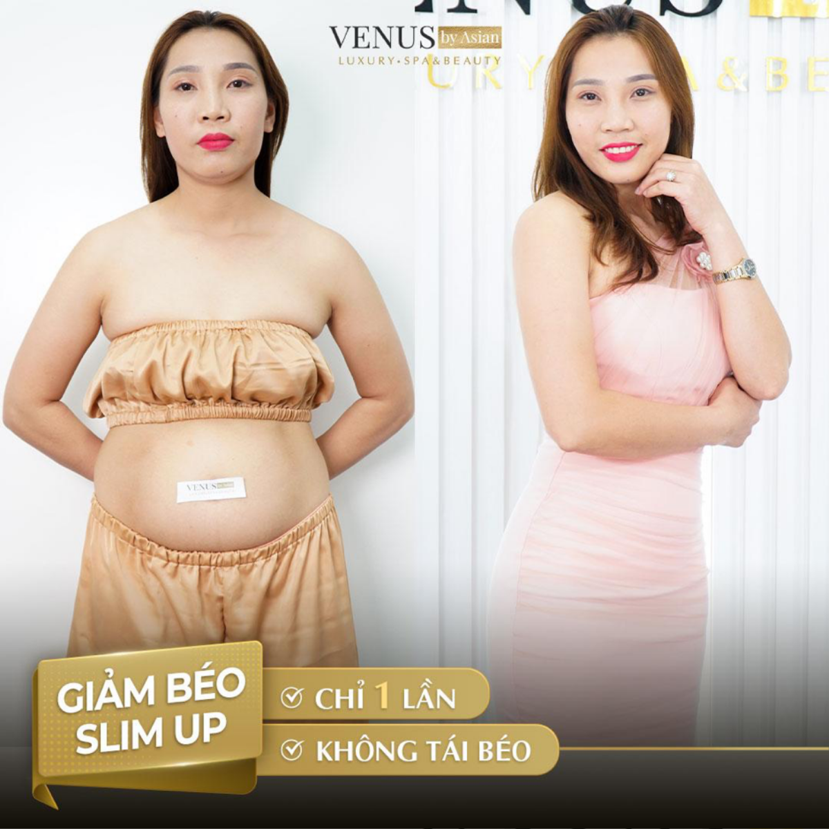 Phòng khám Venus By Asian - Địa chỉ làm đẹp uy tín tại Việt Nam năm 2021 Ảnh 6