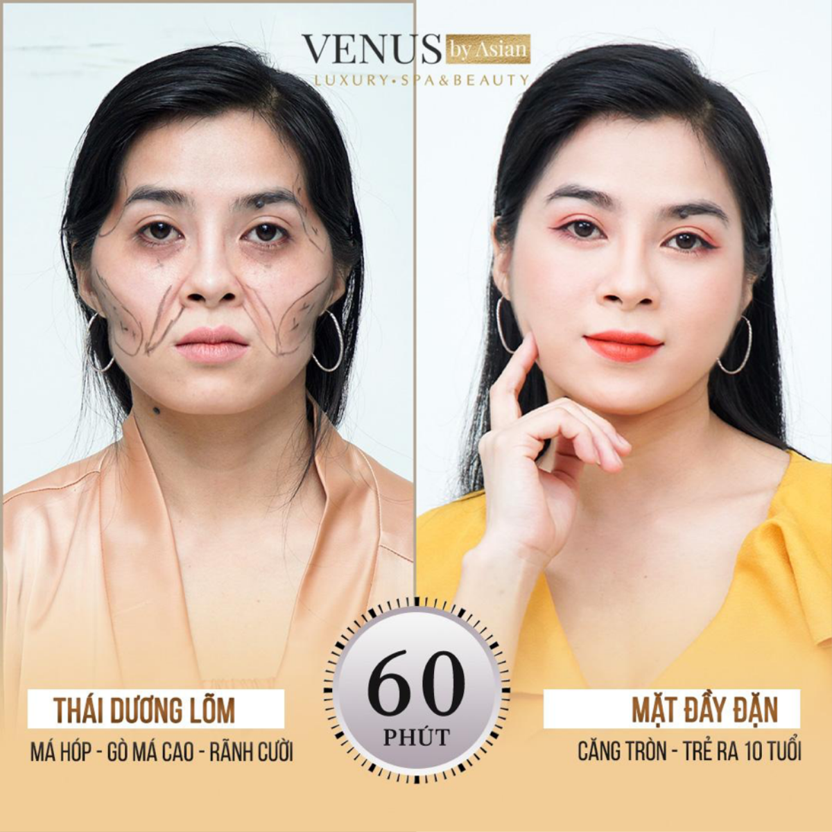 Phòng khám Venus By Asian - Địa chỉ làm đẹp uy tín tại Việt Nam năm 2021 Ảnh 4